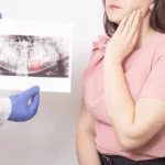 Wisdom tooth pain relief at Topeka Oral Surgery