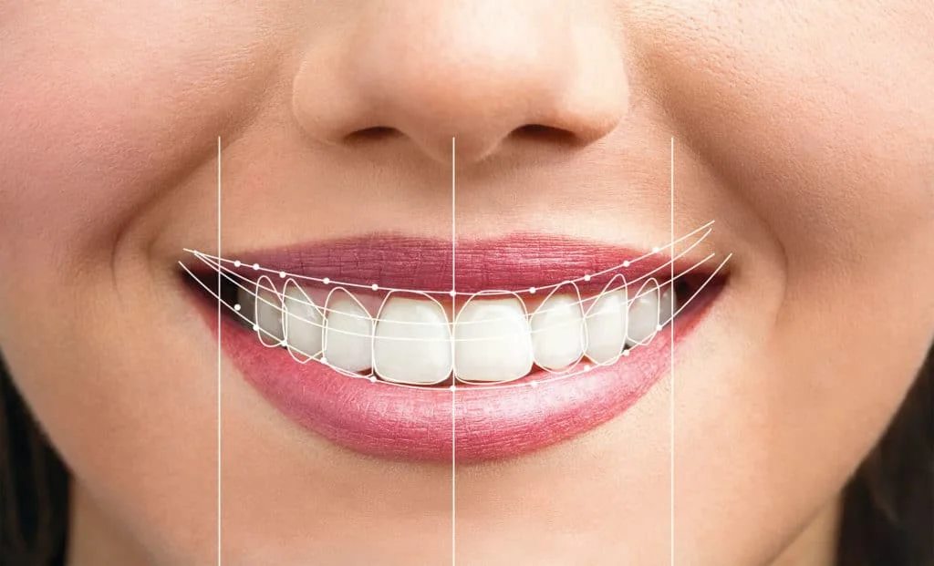 Dental Implants and Your Health: The Bigger Picture